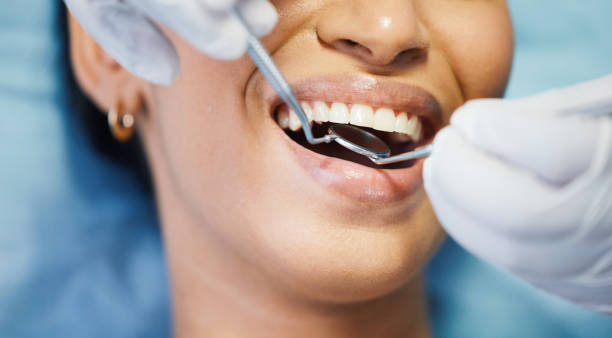 Best Emergency Dental Care for Abscessed Tooth in Bent, NE